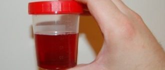 Моча цвета гранатового сока