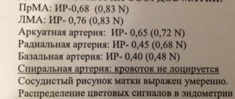 Допрел сосудов матки
