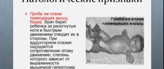 Дисплазия или аддукторный спазм?