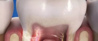 Чувствительность зуба