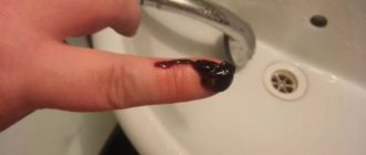 Месячные после чистки