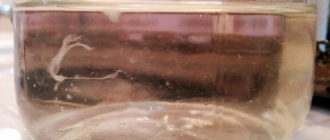 Волокна в моче у ребенка