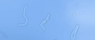 Чёрные ниточки в глазах