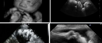 Вредно ли УЗИ на 38 неделе беременности