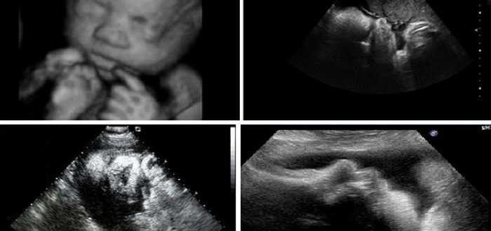 Вредно ли УЗИ на 38 неделе беременности
