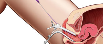 Можно ли развязать трубы?