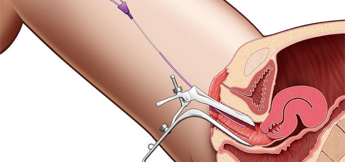 Можно ли развязать трубы?