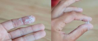 Молочница, воспаление яичников, выделения из груди