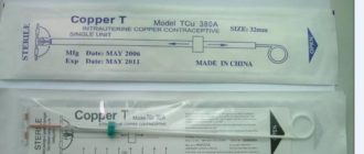 Внутриматочная спираль pregna model tcu 380a