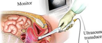 Девственность через УЗИ