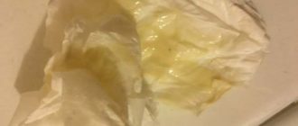 Выделение коричневого цвета на 33 неделе беременности