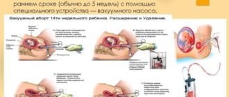 Верно ли назначено лечение после выкидыша