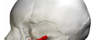 Деформация черепа чуть выше височной кости, начались головные боли