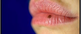На губе родинка с красным вкраплением