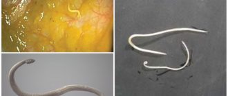 Можно ли избавиться от хронического энтеробиоза?