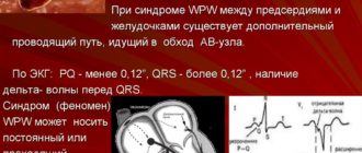 Двухклапанное сердце, clc и wpw феномен у ребенка