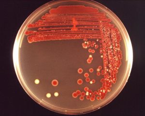 В зеве обнаружили бактерию serratia liquefaciens