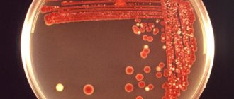 В зеве обнаружили бактерию serratia liquefaciens