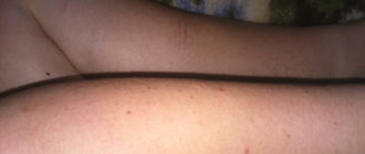 Чешется все тело не сильно но часто