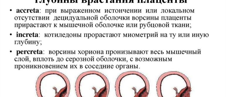 Врастание плаценты