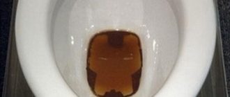 Месячные выходят только при походе в туалет