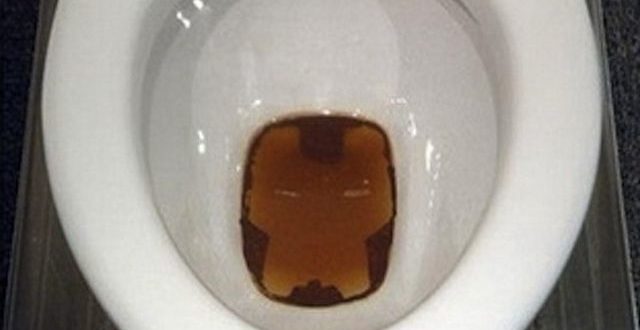 Месячные выходят только при походе в туалет