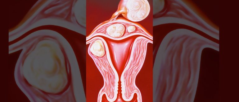 Девственница, долгие месячные