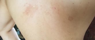 На спине пятно серого цвета