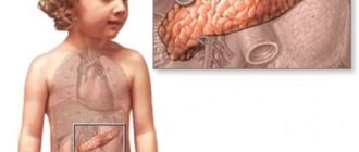 ДЖВП, ФРЖ, реактивное увеличение поджелудочной железы у ребенка 7 лет