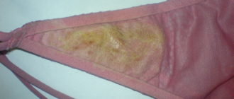 Выделения на трусиках у девочки