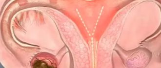 Что может быть после удара в матку?