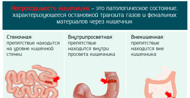 Эли-жкт-тест12