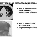 Чем заменить МРТ шейного отдела?