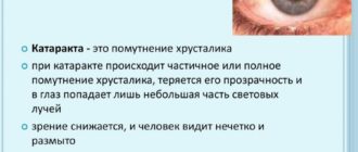 Может ли влиять на развитие катаракты?