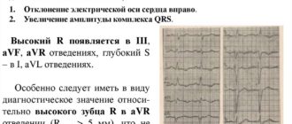 Можно ли при гипотрофии левого желудочка принимать Конкор