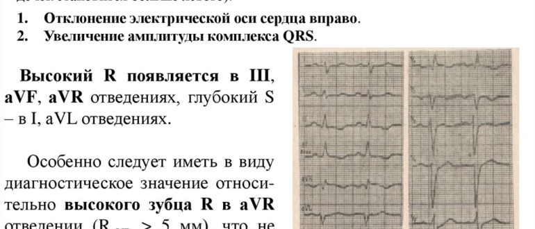Можно ли при гипотрофии левого желудочка принимать Конкор