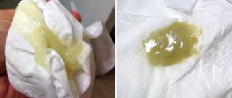 Выделения в начале беременности