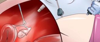 Может ли гинеколог узнать даты менструаций?