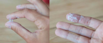 Выделения не прекращаются