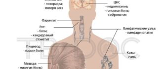 ВИЧ симптоматика
