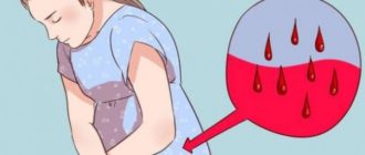 Месячные начались раньше и тошнит