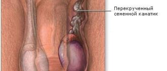 Можно ли жить без яичек