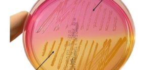 В ухе стафилококк эпидермис