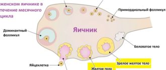 Доминантный фолликул 15 мм