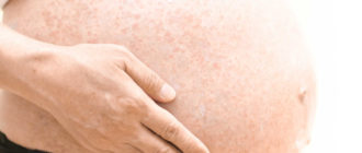 Чешется тело во время беременности