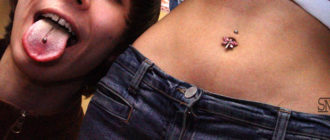 Долго выделяется лимфа из проколов