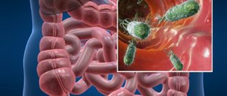 Частые кишечные инфекции
