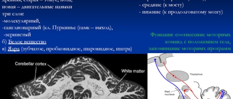 Мозжечок расширение борозд