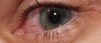 Мутно видит половина глаза после удаления металической стружки