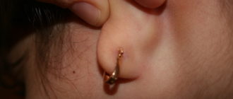 Воспаление мочки уха на месте прокола